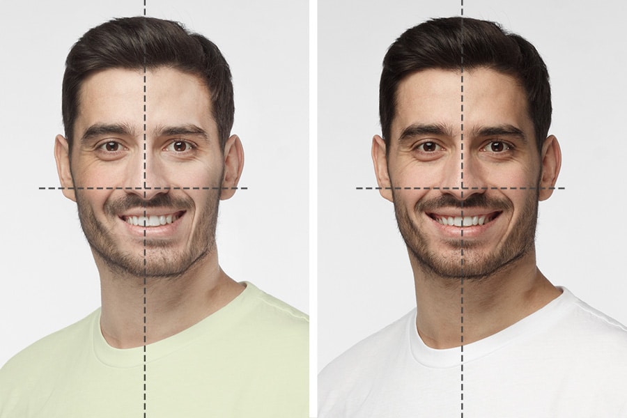 asymmetrical face exercises
