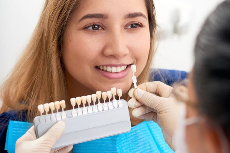 Are Veneers Covered By Insurance EVDP